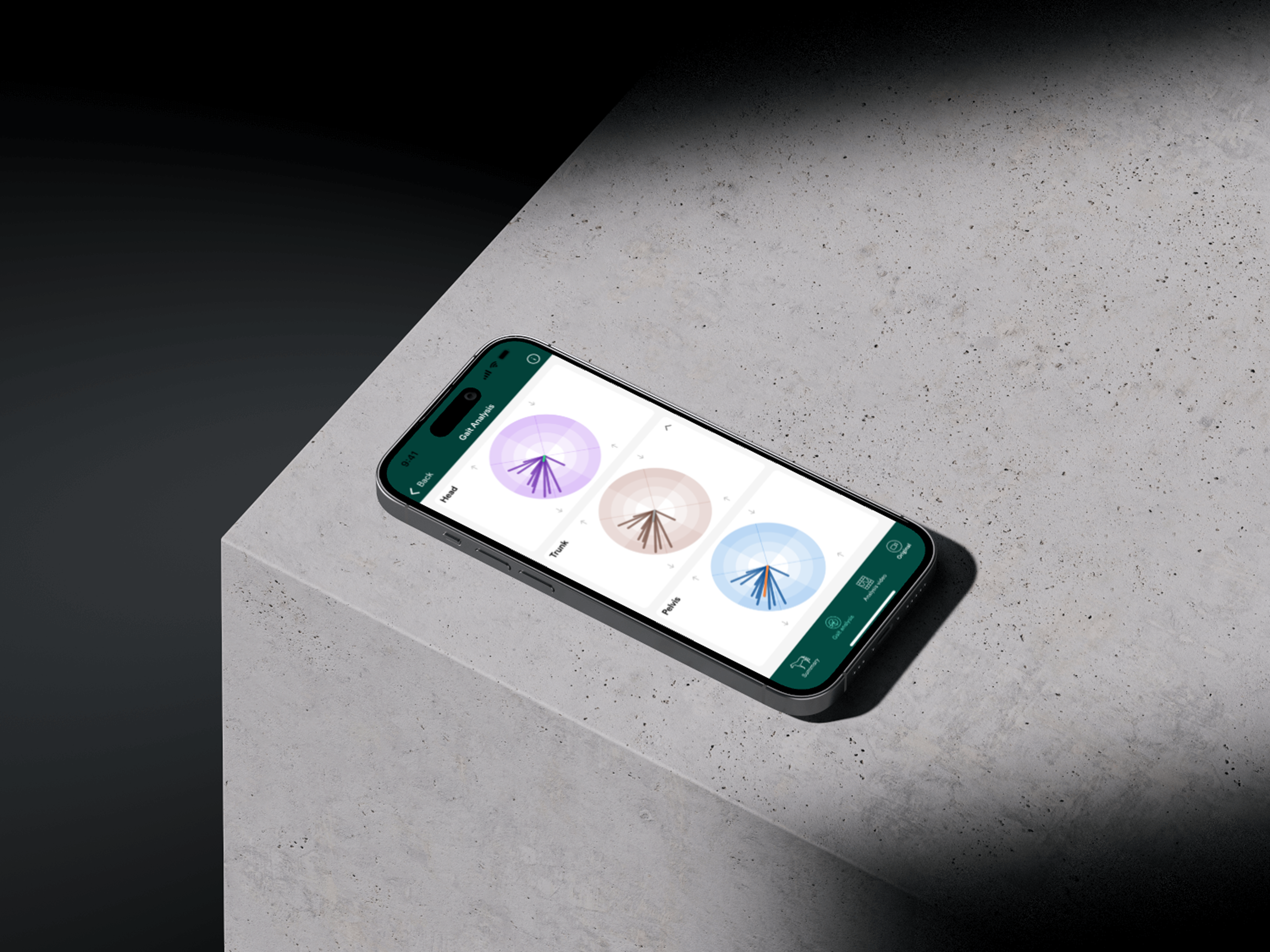 Customised UI elements